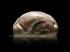 Cum arata cel mai ciudat creier uman din lume-1
